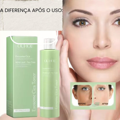 CALMANTE FACIAL