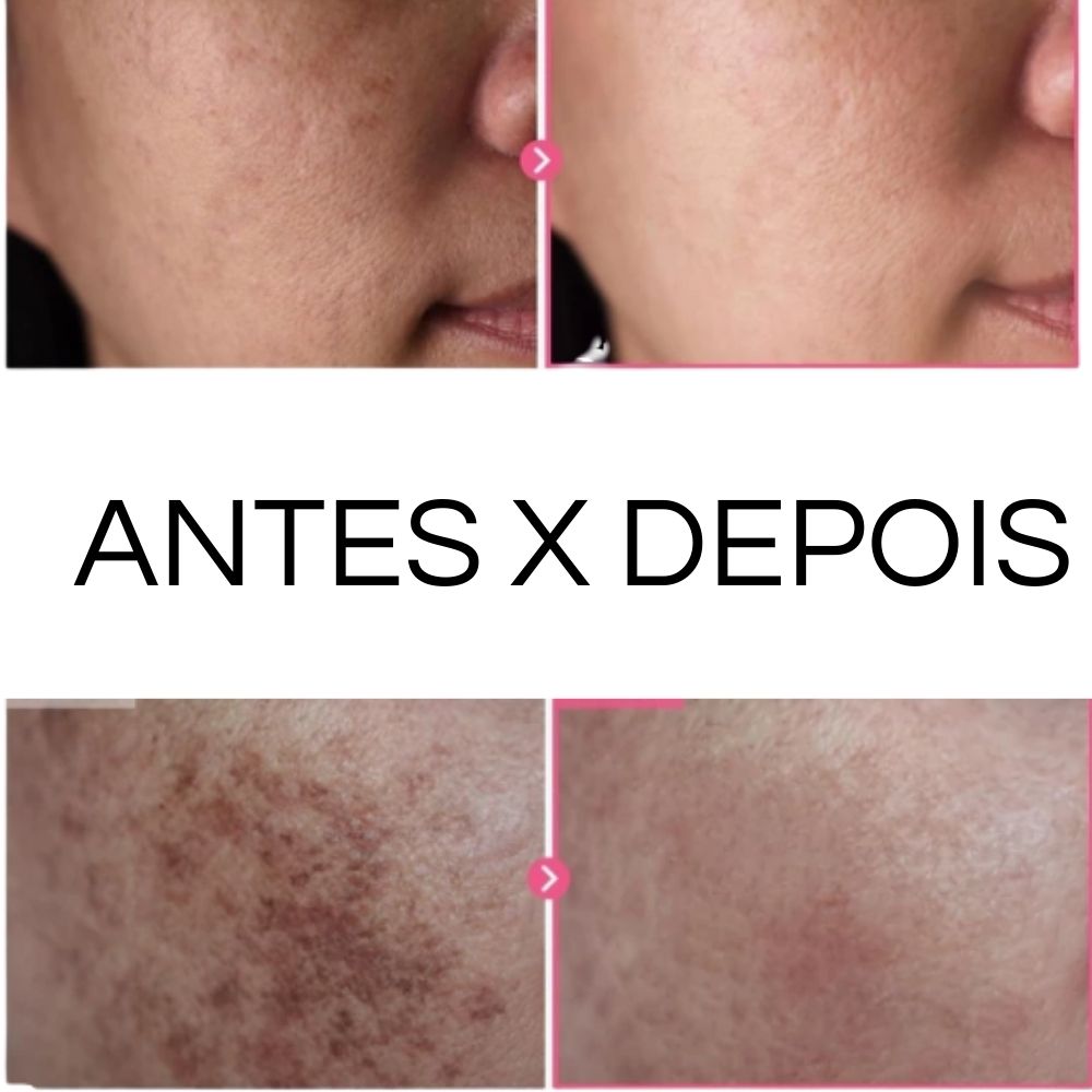 LUMIGLOW - CREME FACIAL COM ARBUTINA