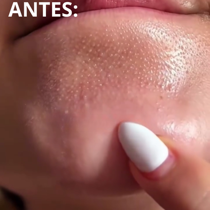 MIXSOON - SUA PELE PERFEITA