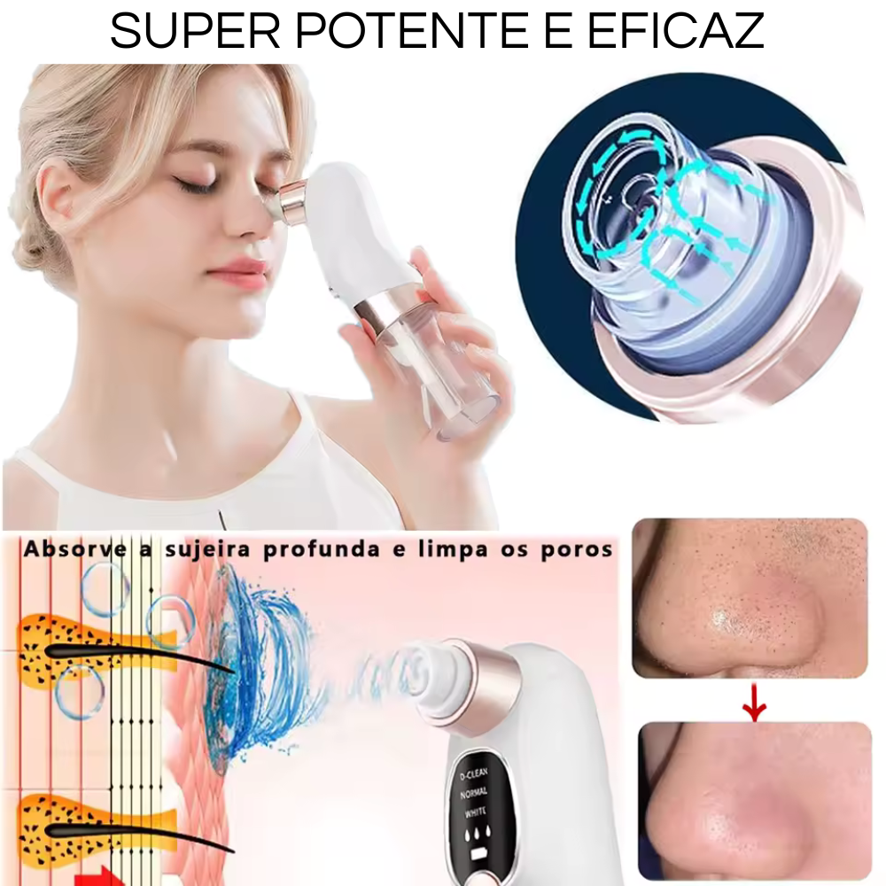 PORECLEAN - remove cravos,espinhas e acnes.