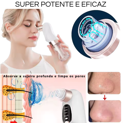 PORECLEAN - remove cravos,espinhas e acnes.