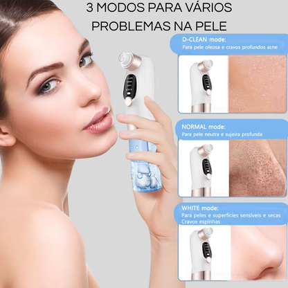 PORECLEAN - remove cravos,espinhas e acnes.